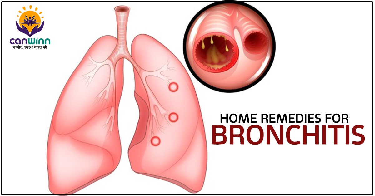 Home remedies for bronchitis