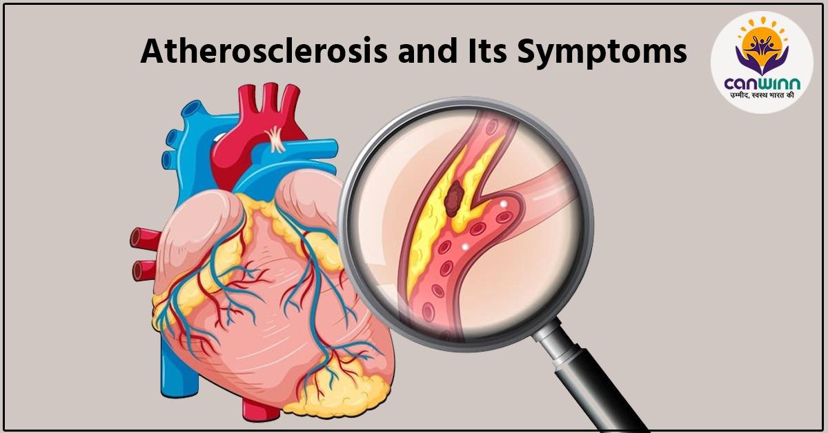 Atherosclerosis and Its Symptoms