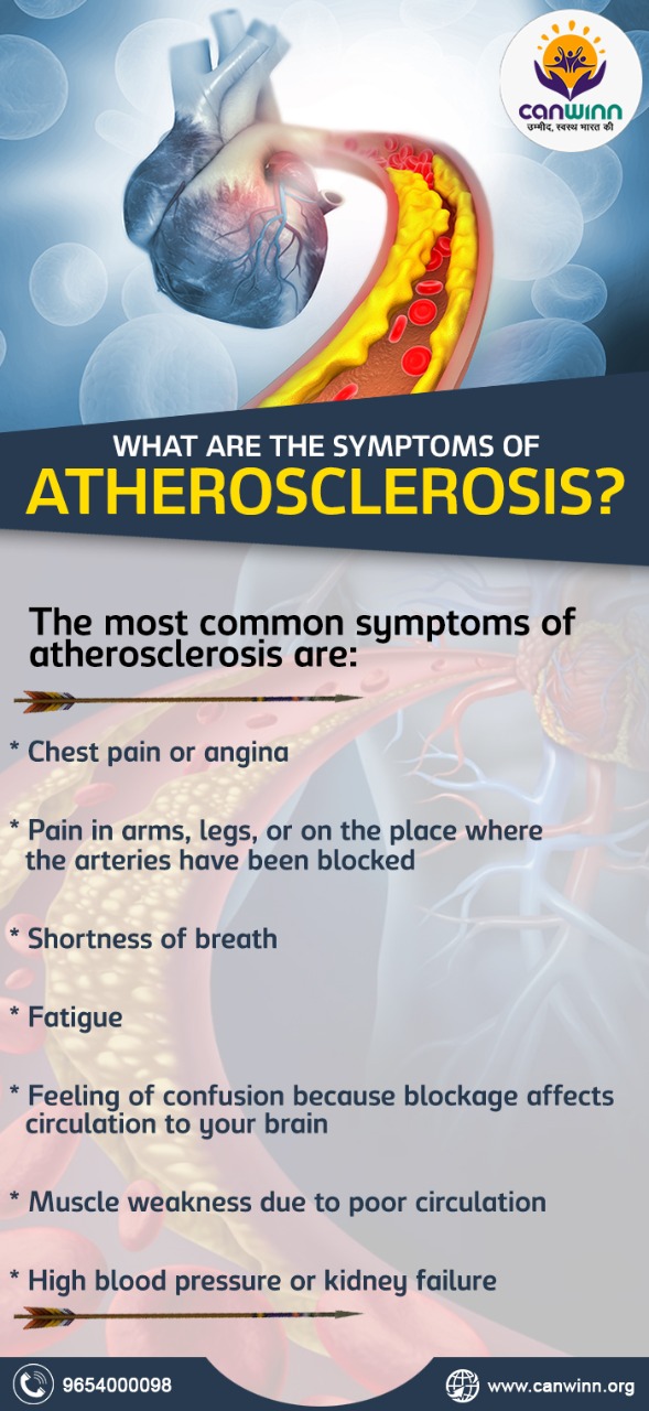 Atherosclerosis and Its Symptoms