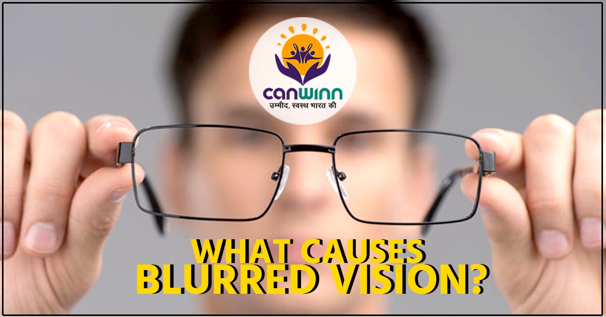 what-causes-blurred-vision-canwinn