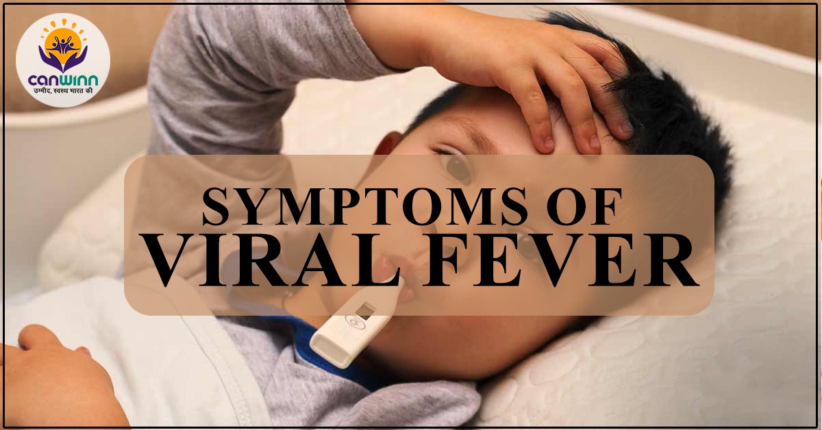 symptoms of viral fever