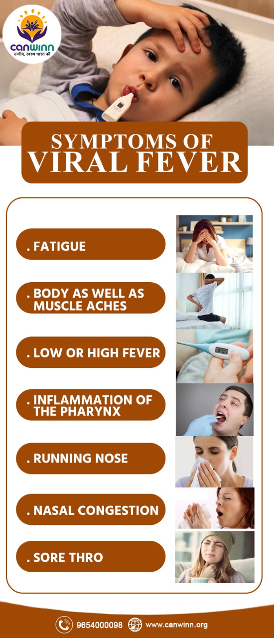symptoms of viral fever