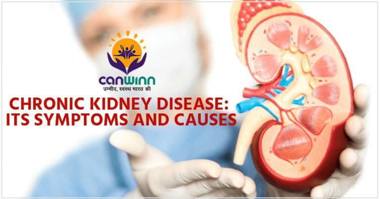 Chronic Kidney Disease: Its Symptoms and Causes - Canwinn Foundation ...