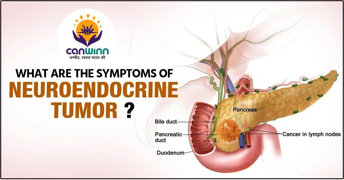 neuroendocrine cancer