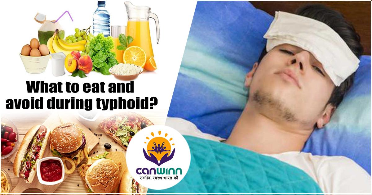 What to eat and avoid during typhoid