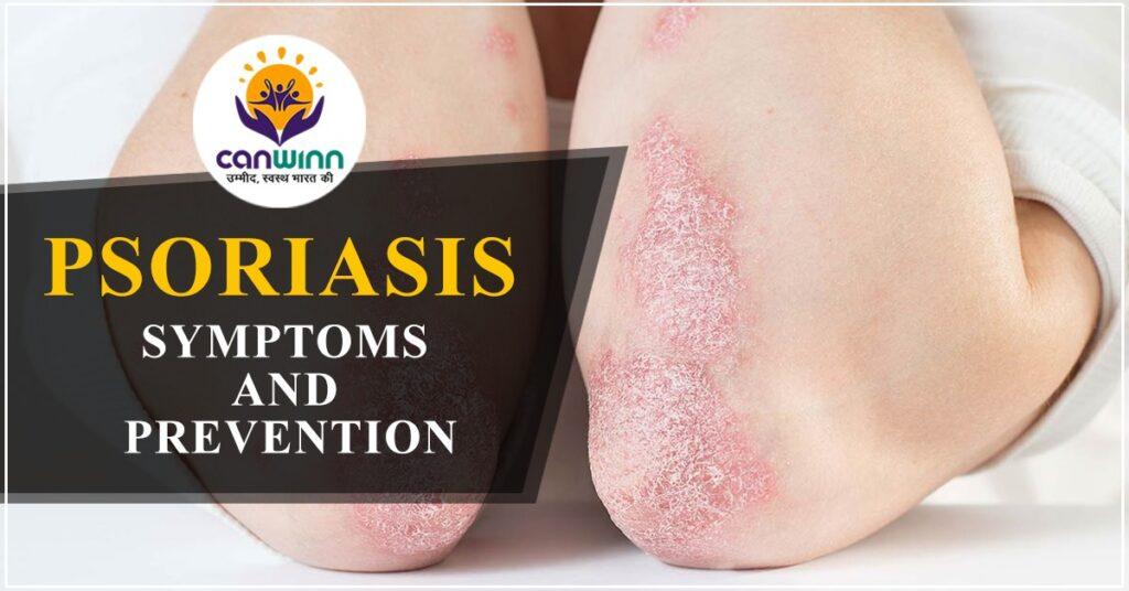 Psoriasis symptoms and preventions Canwinn Foundation