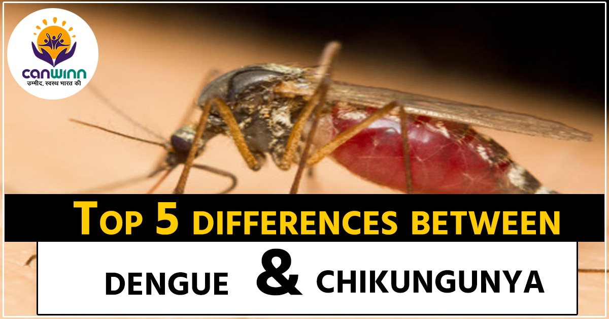 Dengue fever causes, Symptoms, Home remedies