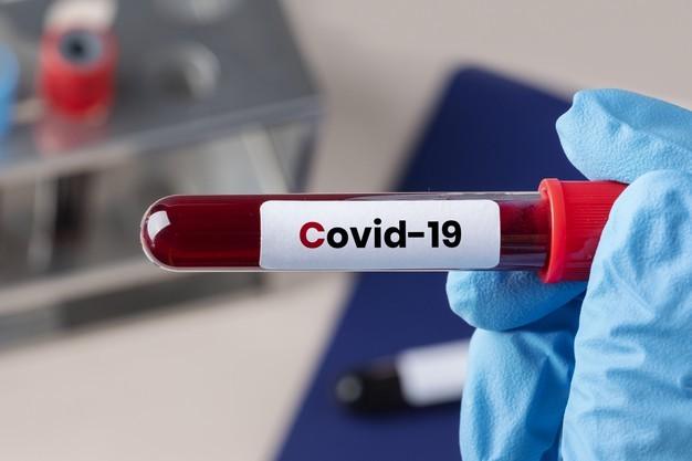 Importance of Blood Donation During Covid-19 Pandemic