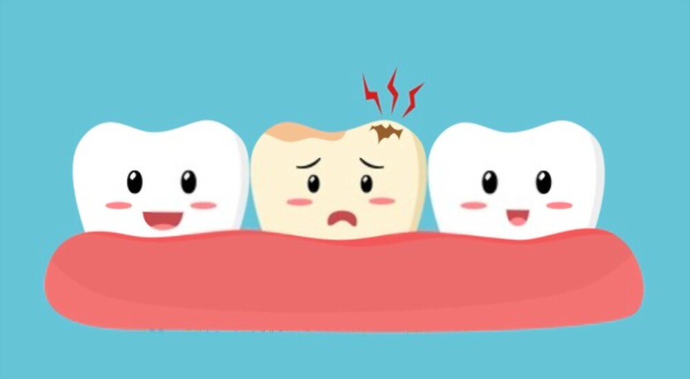 cavities problem in teeth