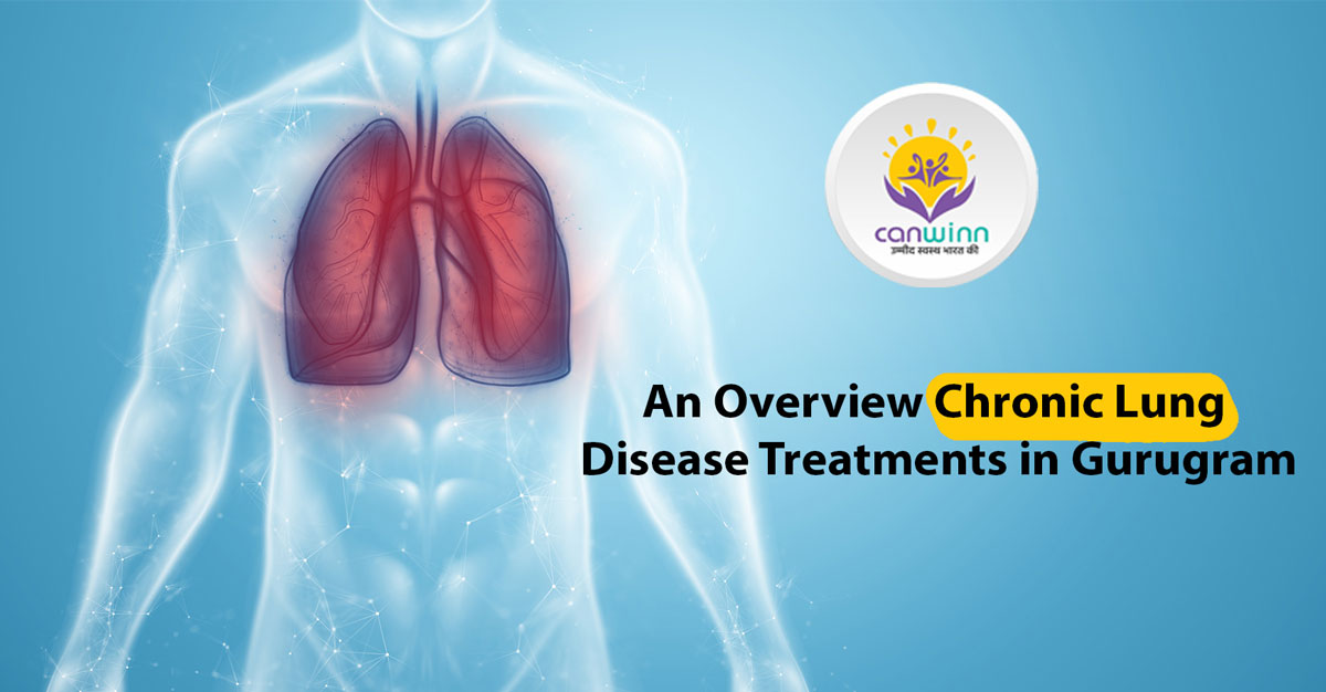 An Overview Chronic Lung Disease Treatments in Gurugram