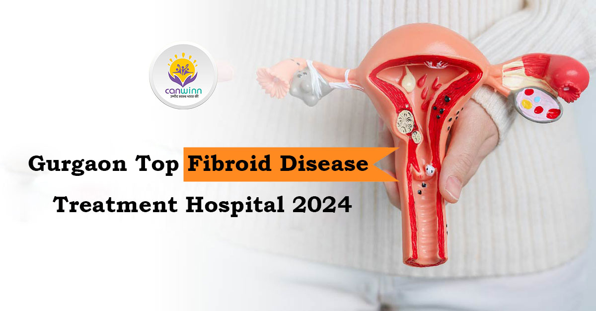 Gurgaon Top Fibroid Disease Treatment Hospital 2024