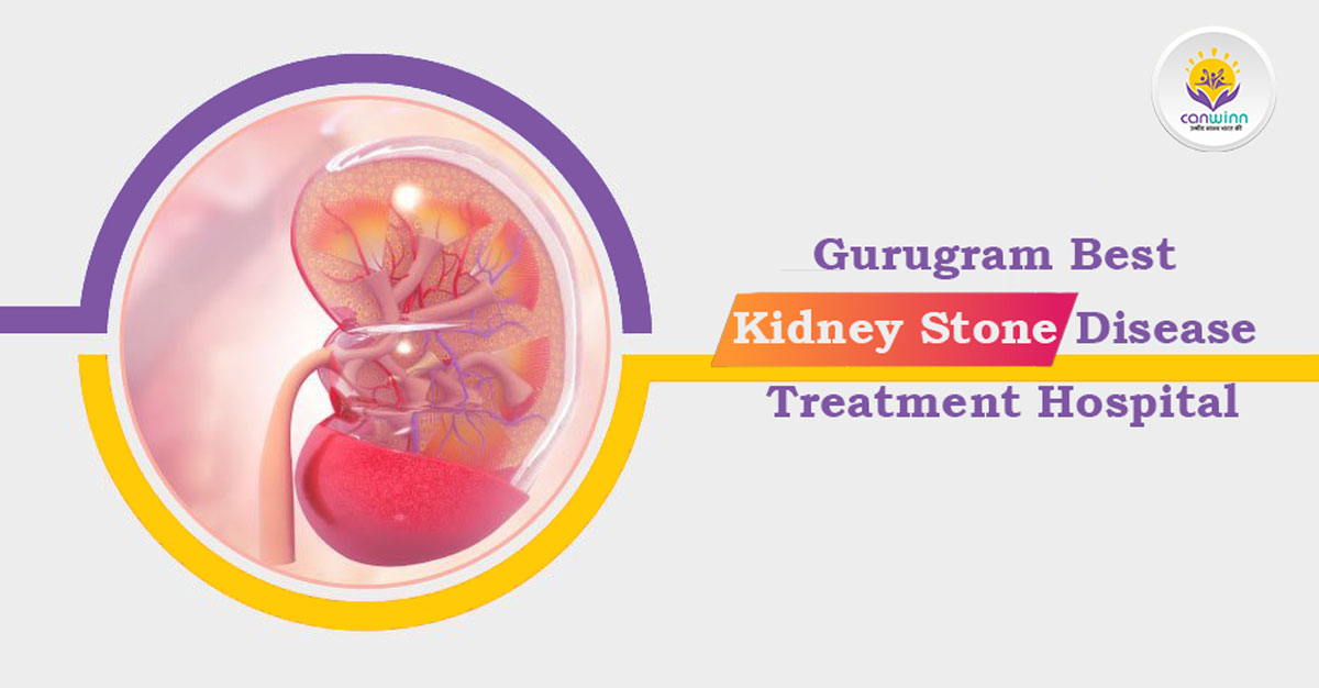 Gurugram Best Kidney Stone Disease Treatment Hospital