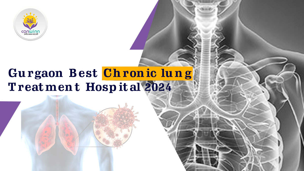 Gurgaon Top Best Chronic lung Treatment Hospital 2024